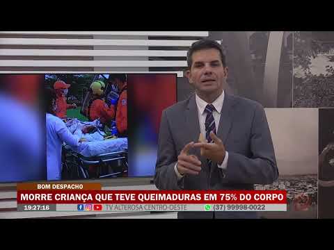 Morre criança que teve queimaduras em 75 do corpo TV Alterosa